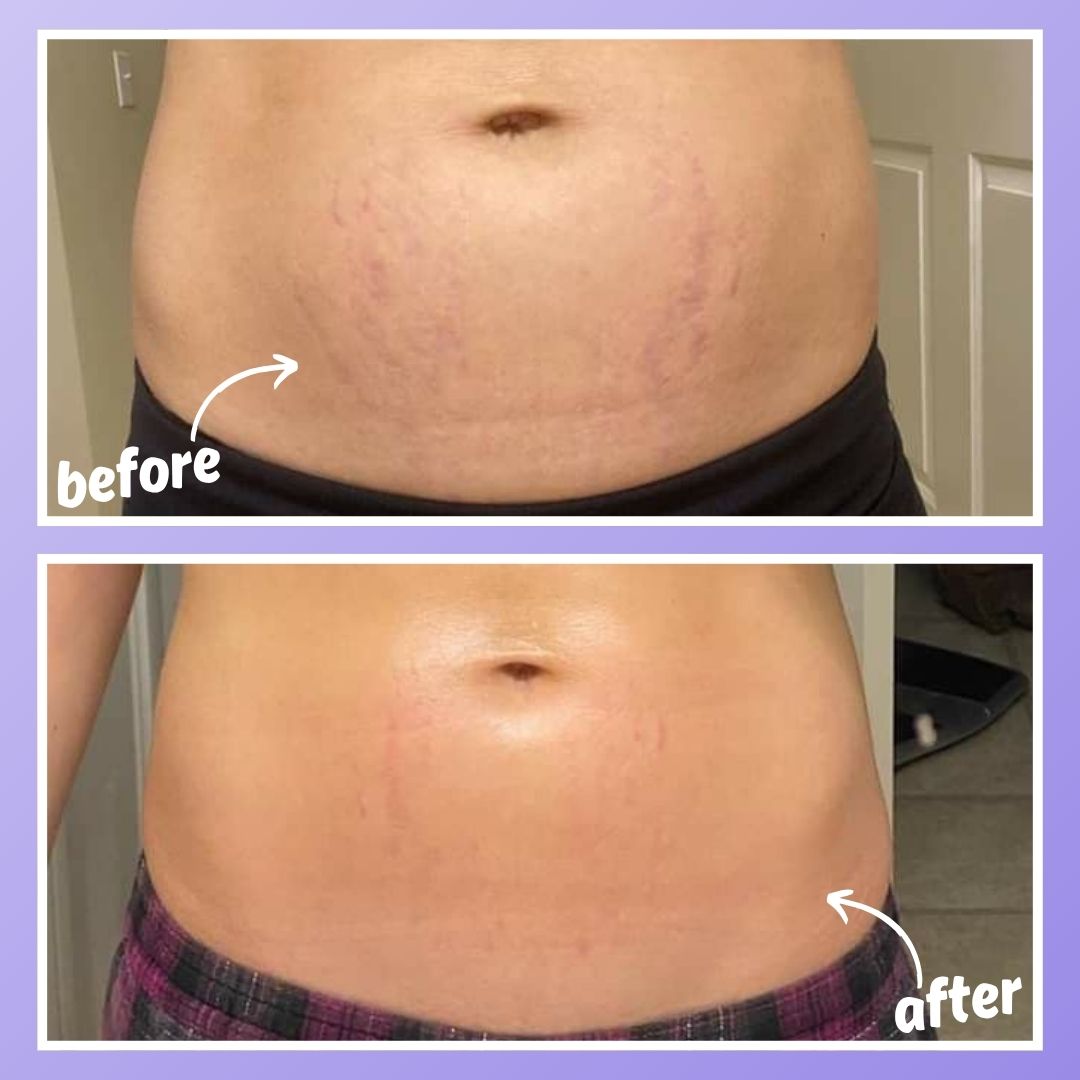 ™ORPURE - Tighten & Smooth Belly Cream