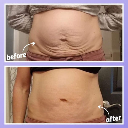 ™ORPURE - Tighten & Smooth Belly Cream