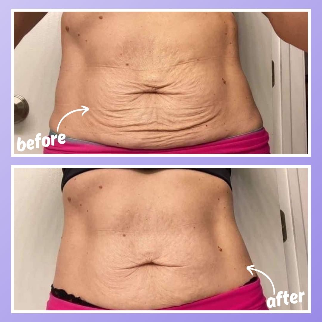 ™ORPURE - Tighten & Smooth Belly Cream